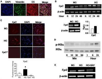 The G-Protein-Coupled Chemoattractant Receptor Fpr2 Exacerbates High Glucose-Mediated Proinflammatory Responses of <mark class="highlighted">Müller Glial Cells</mark>